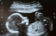 8 Boys and Wanting a Girl